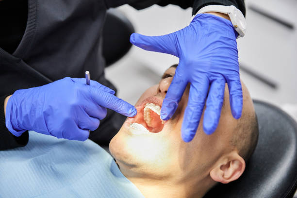 Best Knocked-Out Tooth (Avulsed Tooth) Treatment in West Palm Beach, FL