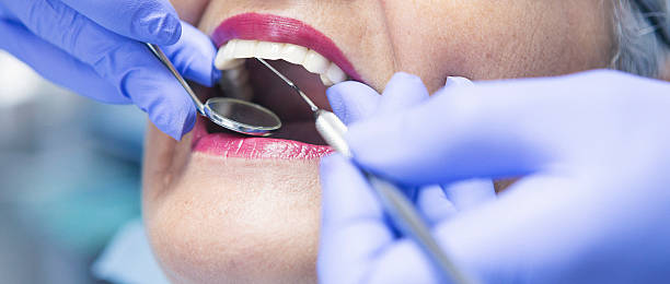 Best Emergency Denture Repair in West Palm Beach, FL